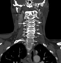 Figure 1a